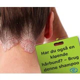 Psoriasis shampoo der lindre godt ved psoriasis i hovedbunden